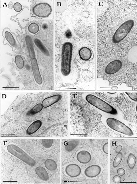 Infection of macrophages by Listeria monocytogenes Intraphagoytic L. monocytogenes (THP1 macrophages)